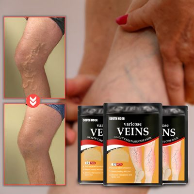Parches para venas varicosas (paquete de 12) VEINPAT